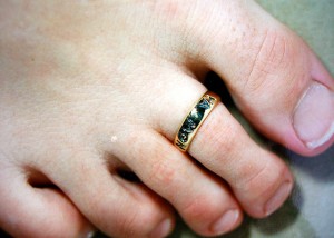 You need fungus free toes to wear toe rings