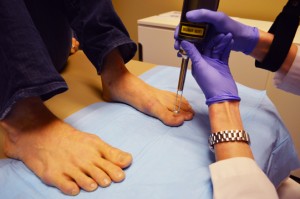 toenail fungus treatment Houston