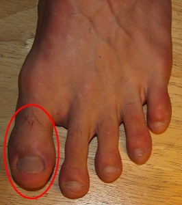 foot conditions
