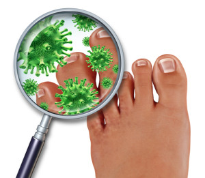 treating toenail fungus