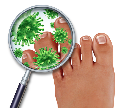 reducing toenail fungus